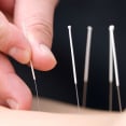 Klassieke acupunctuur Eindhoven & Best