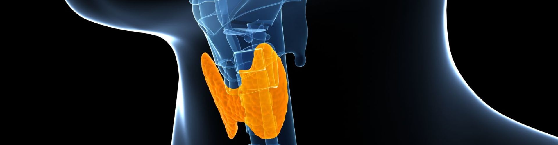 Ziekte van Hashimoto Ziekte van Hashimoto