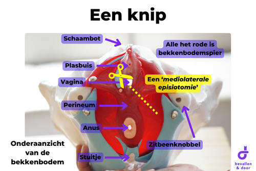 Littekenmassage na een knip - Bekkenbodemoefeningen na een knip