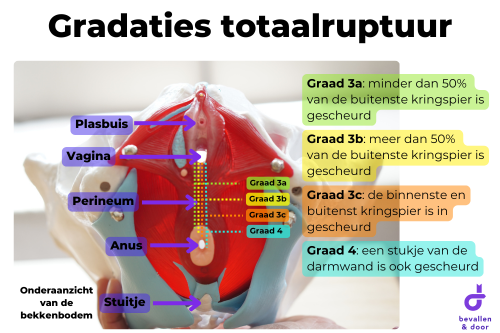 Totaalruptuur - littekenmassage - bekkenbodemoefeningen - pijn - incontinentie