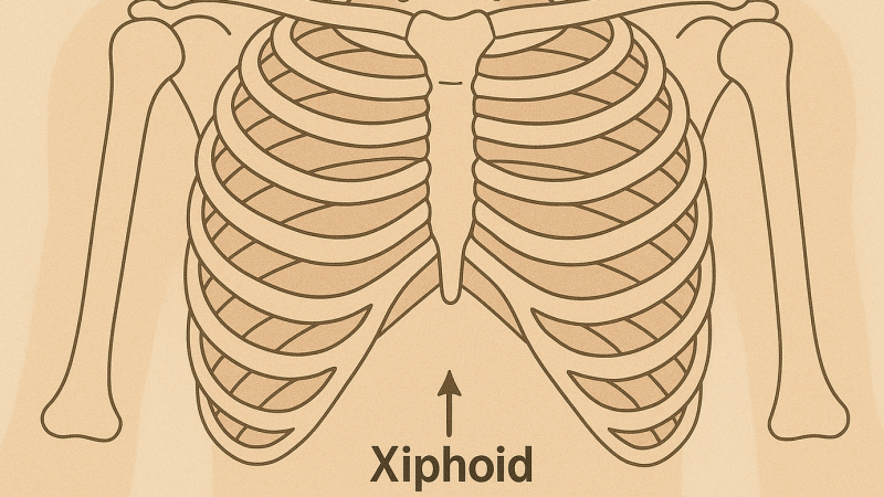 pijnlijk Xiphoid