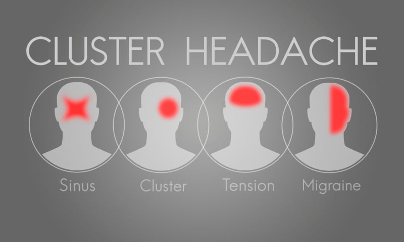 clusterhoofdpijn door stress
