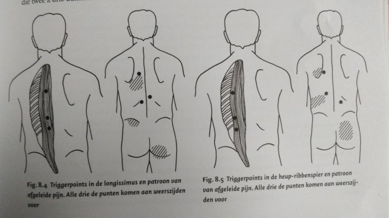 hoge-rugpijn-links-rechts