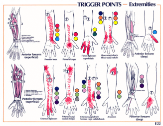 Alles Over Tintelingen In Arm- Oorzaken & Behandeling