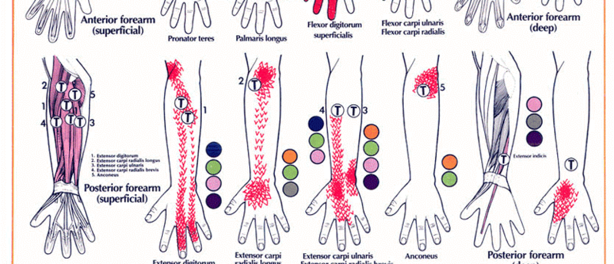 Cervicogene hoofdpijn; Oorzaken en Oplossingen