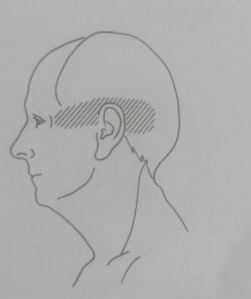 triggerpoints-hoofdpijn-suboccipitale-spierende-onderachterhoofdspieren-deel-2