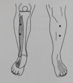 triggerpoints-in-de-lange-strekker-van-de-tenen-extensor-digitorum-longus-pijn-bovenkant-voet-wreef