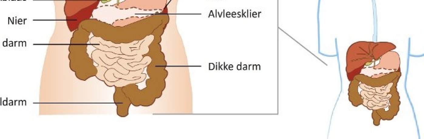 Alvleesklier diabetes