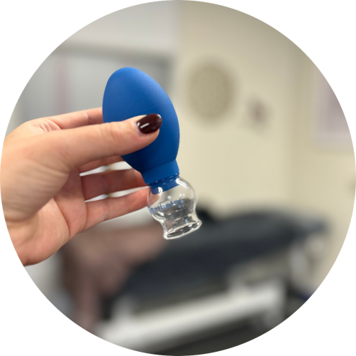 Tarieven - Transformational Cupping - Cupping Staphorst