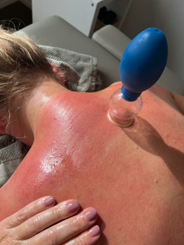 Transformational Cupping