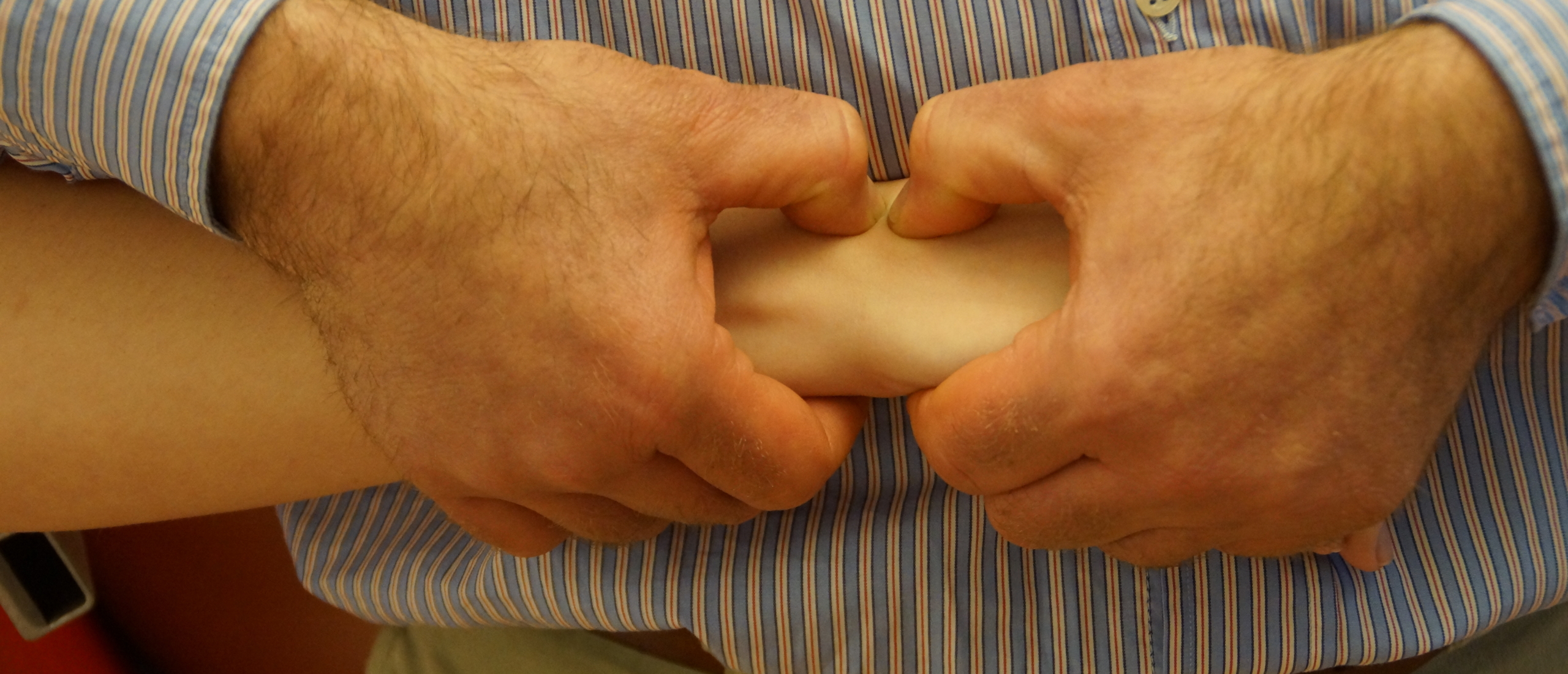 carpal subluxation manipulation