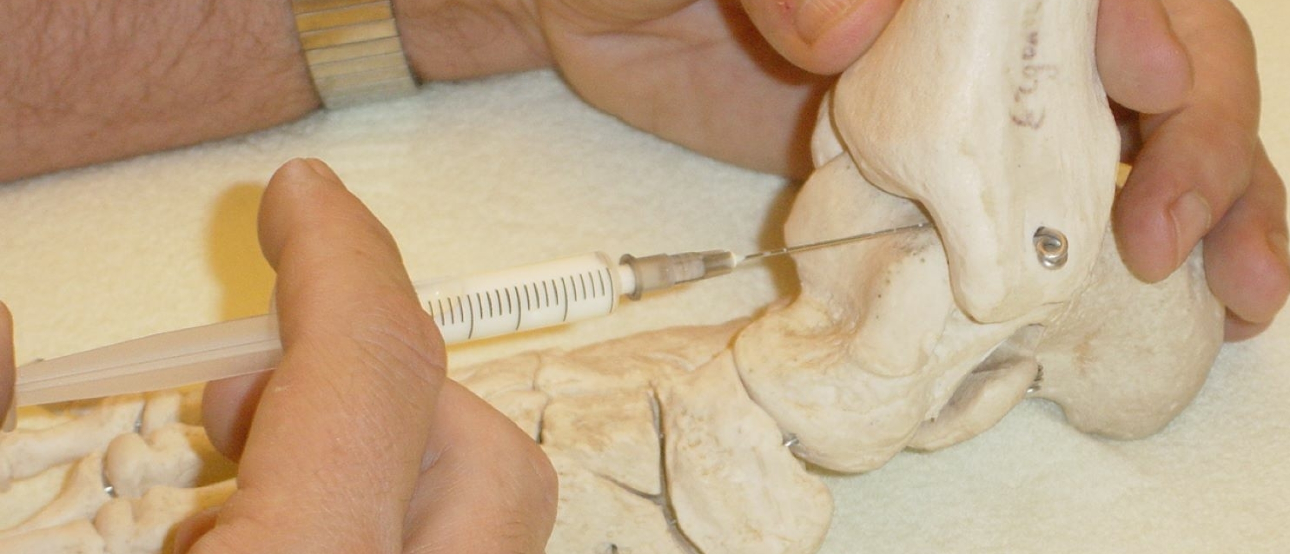 Injection technique of the ankle joint