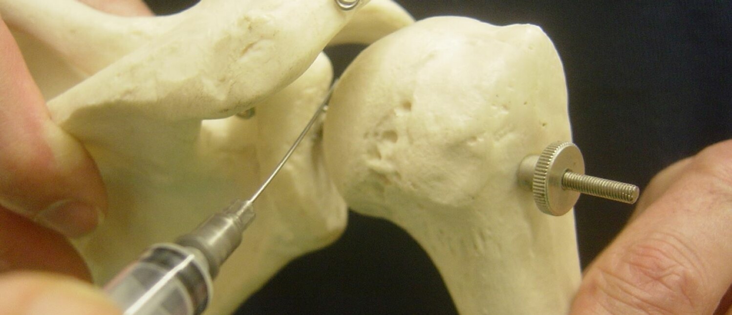 Injections with local anaesthetic in orthopaedic medicine