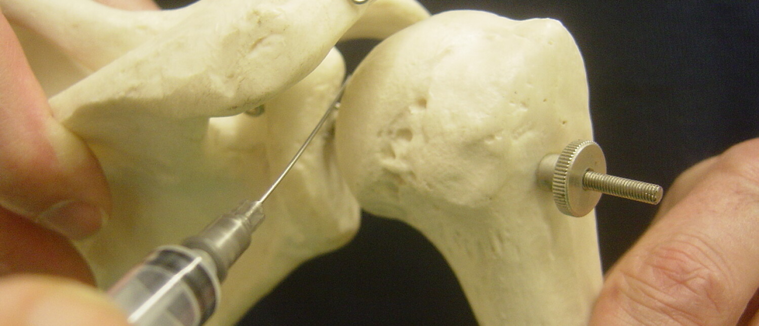 How to inject the shoulder joint