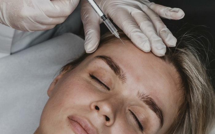 Vrouw ontvangt een veilige Botox behandeling op het voorhoofd bij De Botoxbar in Ottoland – helpt rimpels te verminderen en het resultaat langdurig te behouden.