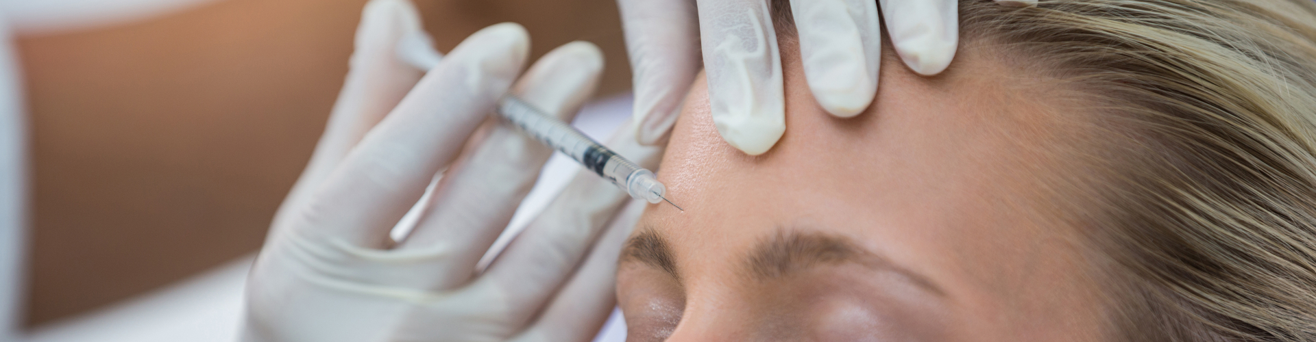 Botox tegen migraine – medische injecties bij chronische migraine Botox tegen migraine behandeling waarbij injecties in het voorhoofd worden geplaatst