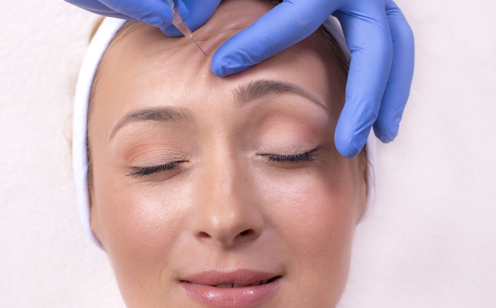 Botox voorhoofd – veilige herhaalbehandeling na 12 tot 16 weken Herhaalbehandeling Botox voorhoofd uitgevoerd door specialist met precieze injectietechniek