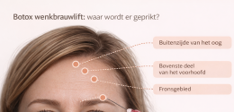 Botox wenkbrauwlift: waar wordt er geprikt?