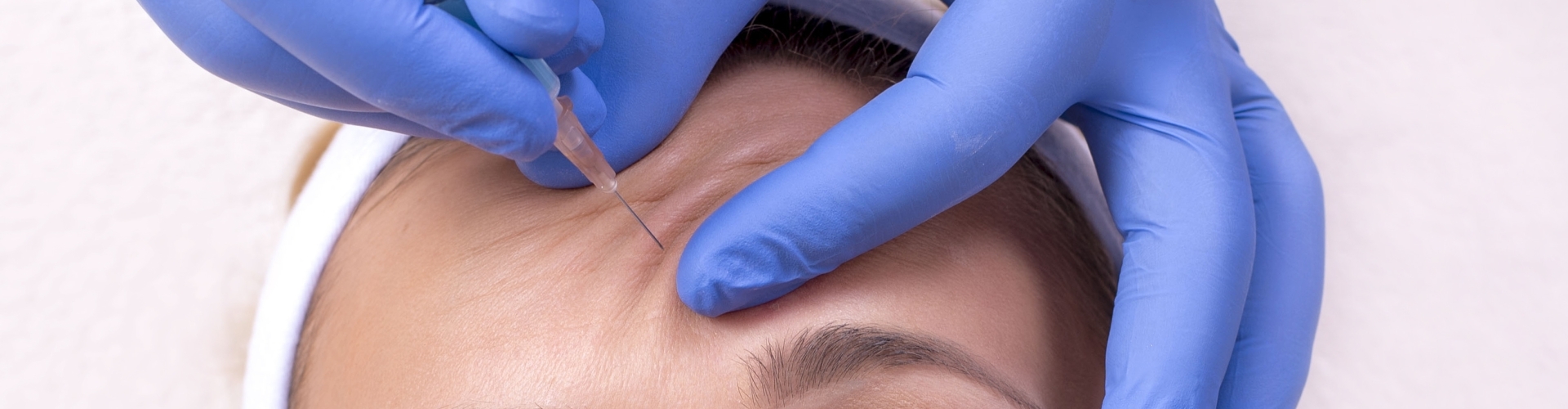 Botoxbehandeling tegen overmatig zweten op het voorhoofd Botox tegen zweten op het voorhoofd bij overmatige transpiratie