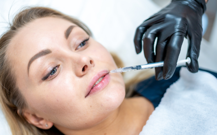 Hoe werken hyaluronzuur fillers?  Monica van De Botoxbar legt uit