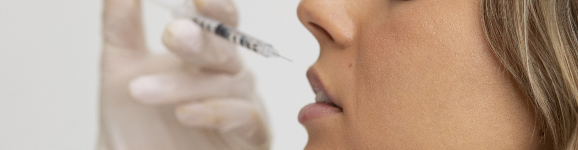 Hyaluronzuur Filler Behandelingen gezet door Monica van De Botoxbar