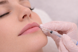 Close-up van lipcontour behandeling met ultradunne naald bij ontspannen cliënt