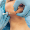 Medische botox behandelingen Medische botox behandelingen tegen migraine, knarsen en meer doe je bij de Botoxbar