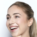 Natuurlijk frisse uitstraling met Botox behandelingen bij De Botoxbar Ottoland Vrouw met een frisse, natuurlijke uitstraling na een Botox behandeling bij De Botoxbar in Ottoland – subtiel resultaat zonder verlies van mimiek, met gebruik van Azzalure (Galderma).
