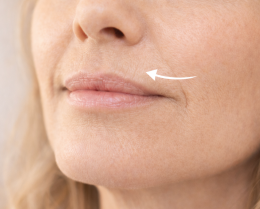 Close-up van fijne verticale lijntjes boven de bovenlip bij vrouw