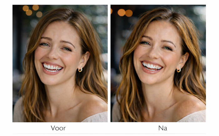 Voor en na foto van gummy smile behandeling met botox waarbij minder tandvlees zichtbaar is en de lach ontspannener oogt
