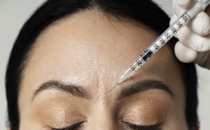 Voor wie botox tegen zweten op het voorhoofd geschikt kan zijn Botox tegen zweten op het voorhoofd bij overmatige transpiratie