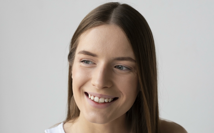 Vrouw lacht ontspannen met natuurlijke glimlach na subtiele gummy smile behandeling met botox