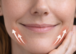 Wat doet Botox bij hangende mondhoeken? De Botoxbar legt uit