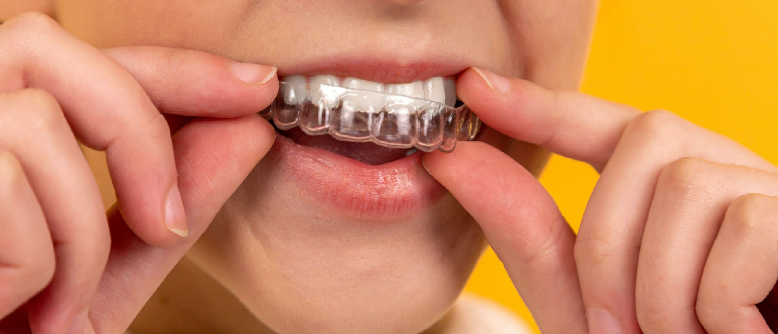 De tandarts-vraag: waarom jij je in je marketing misschien focust op het verkeerde