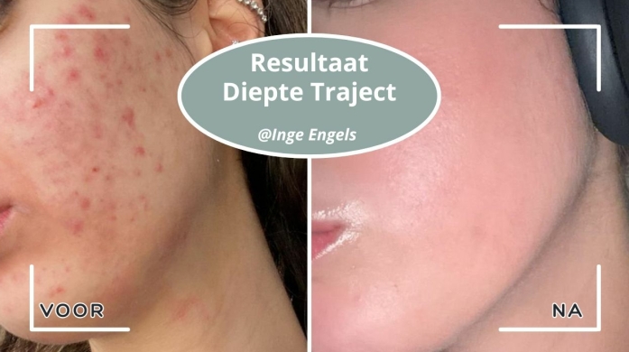 Voor en na resultaat Diepte Traject Inge Engels Voor en na resultaat traject Inge Engels
