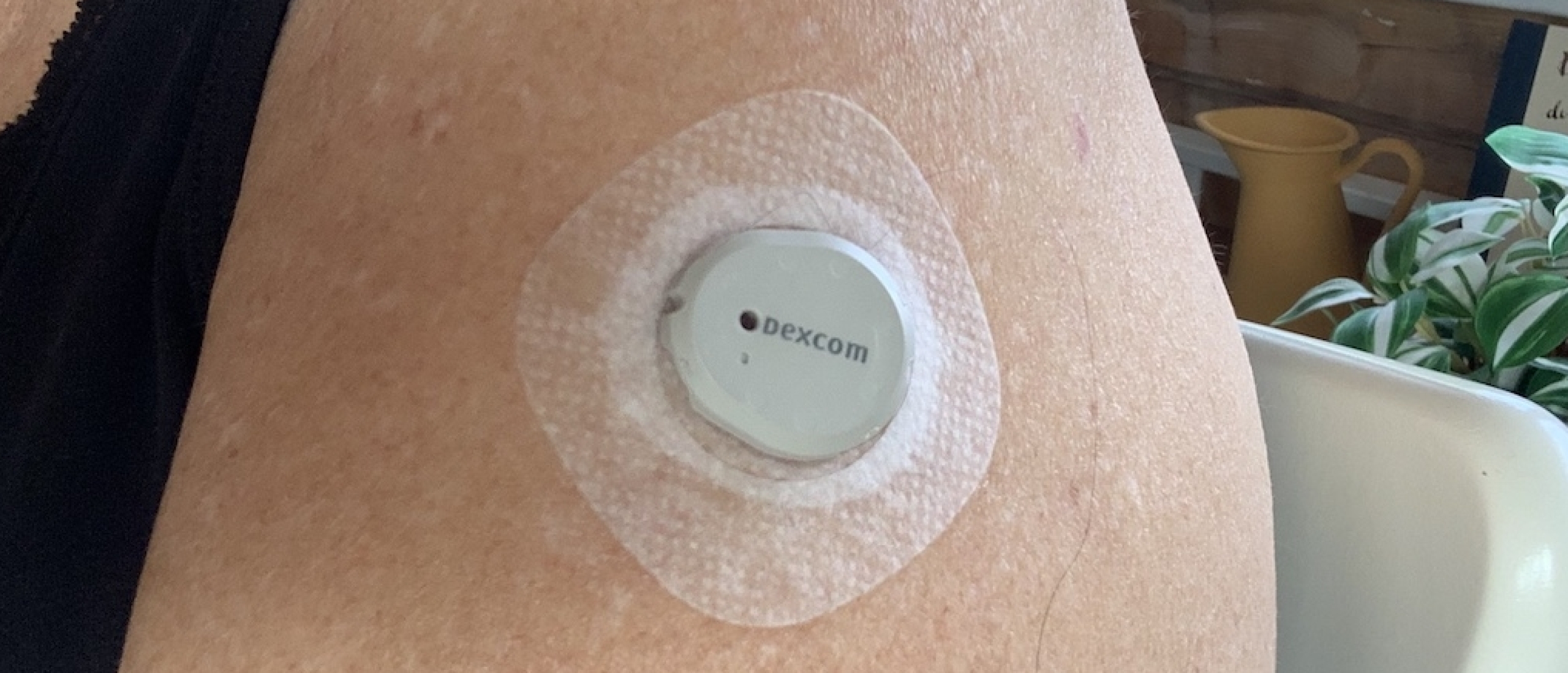 CGM: handig hulpmiddel of stressmaker?