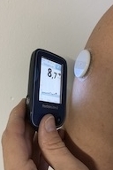 diabetes complicaties reader sensor