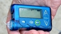 diabetes insulinepomp