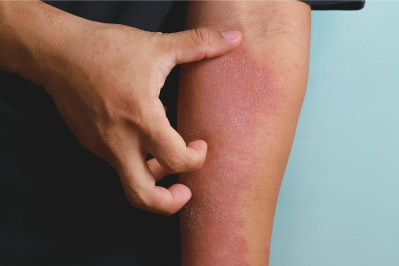 zo herken je misleiding