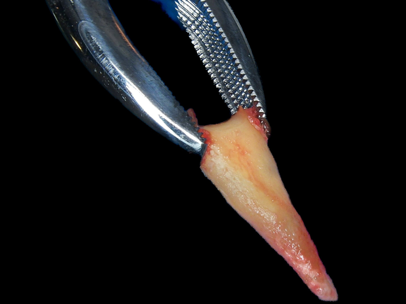 Tand tooth transformer