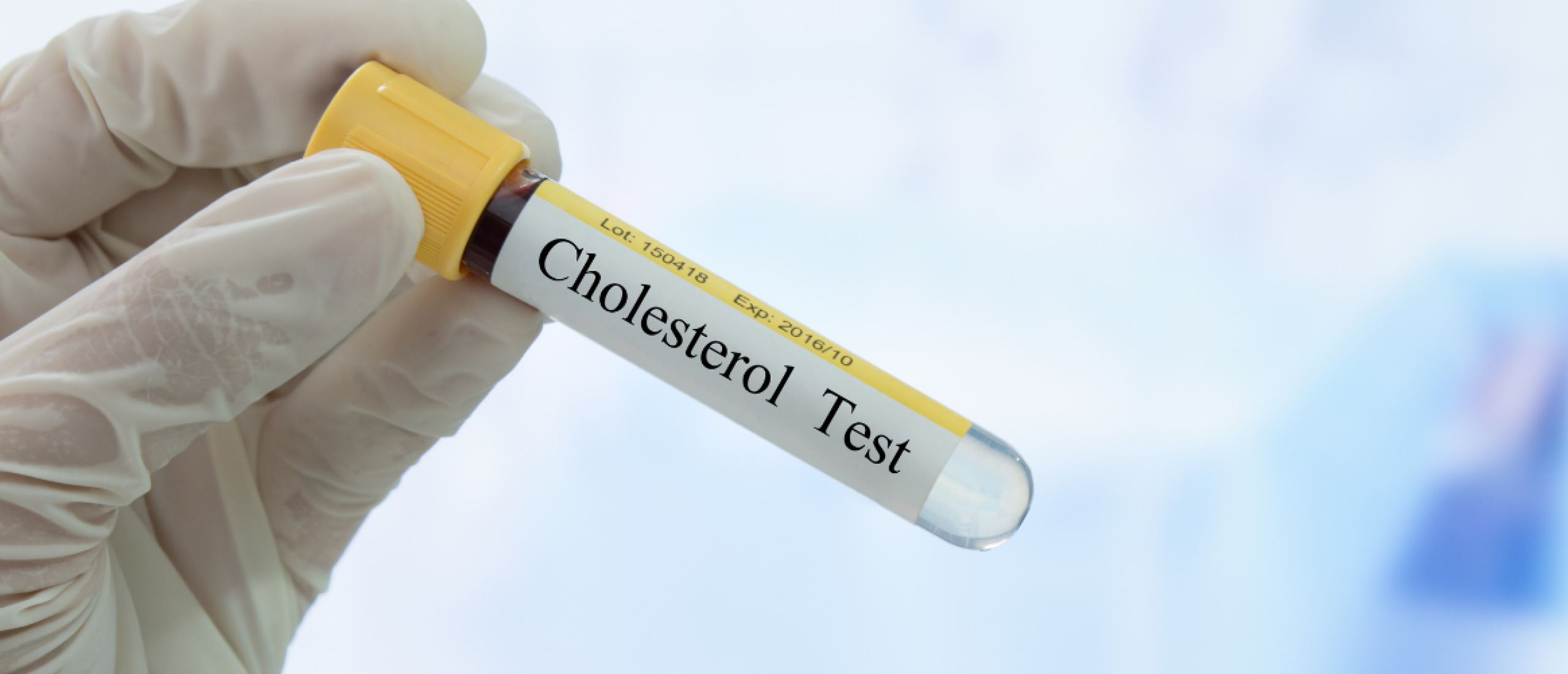 Slecht Cholesterol Bestaat Niet