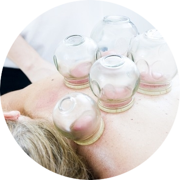 Cupping therapie