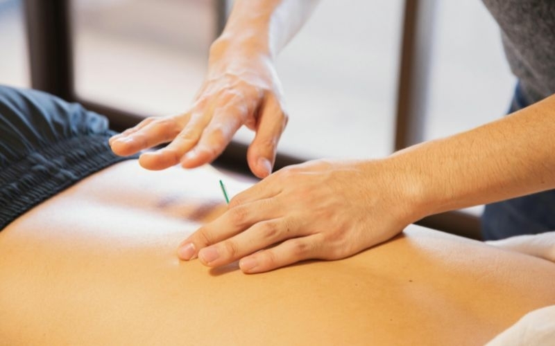Fysiotherapie dry needling
