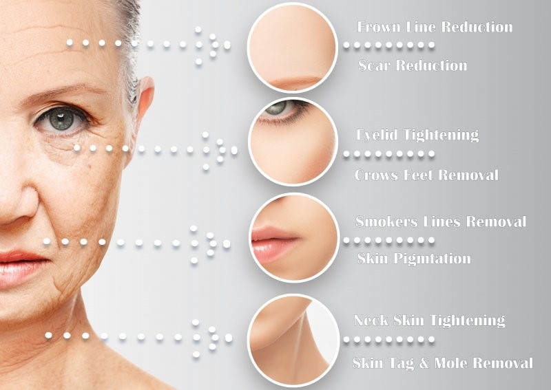 plasma voordelen en nadelen