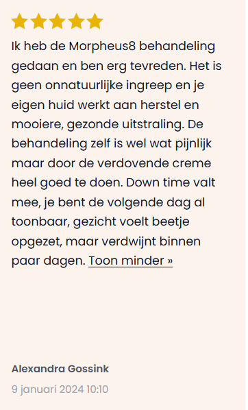 recensie morpheus8 voor en nadelen