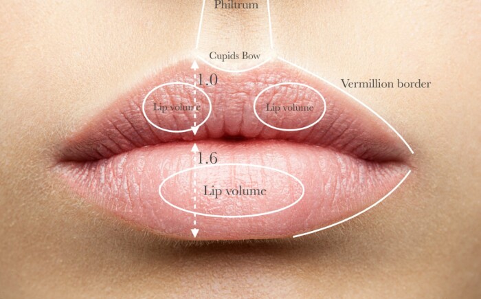 lip fillers behandeling