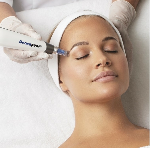 dermapen microneedling den haag