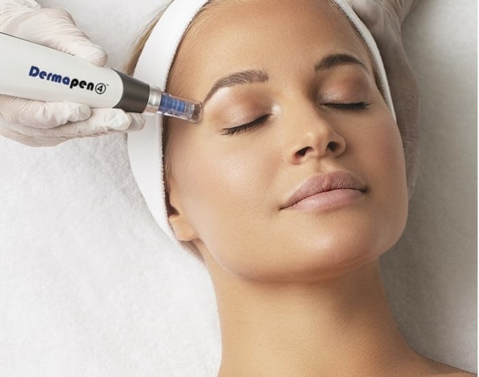 dermapen microneedling den haag