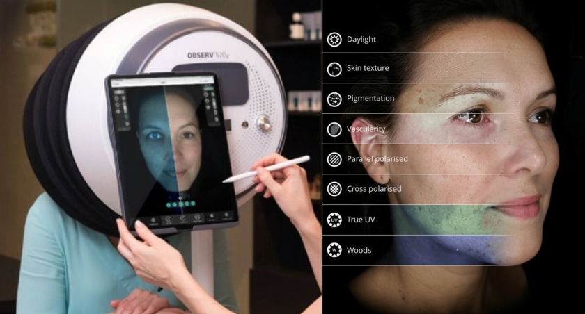 Observ 520 huidanalyse gezicht