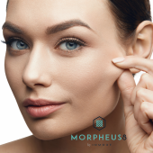 Morpheus8 behandeling microneedling voor en na